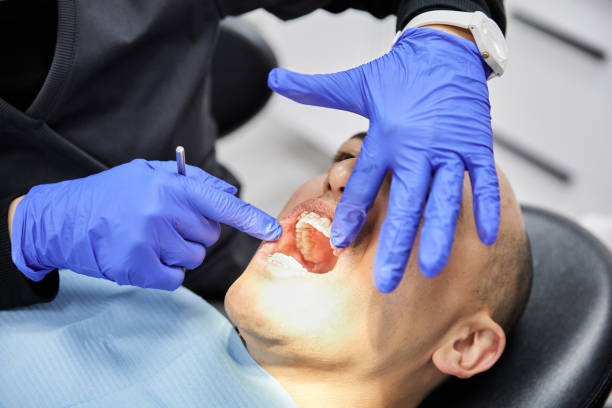 Best Emergency Treatment for Oral Infections in Shasta, CA